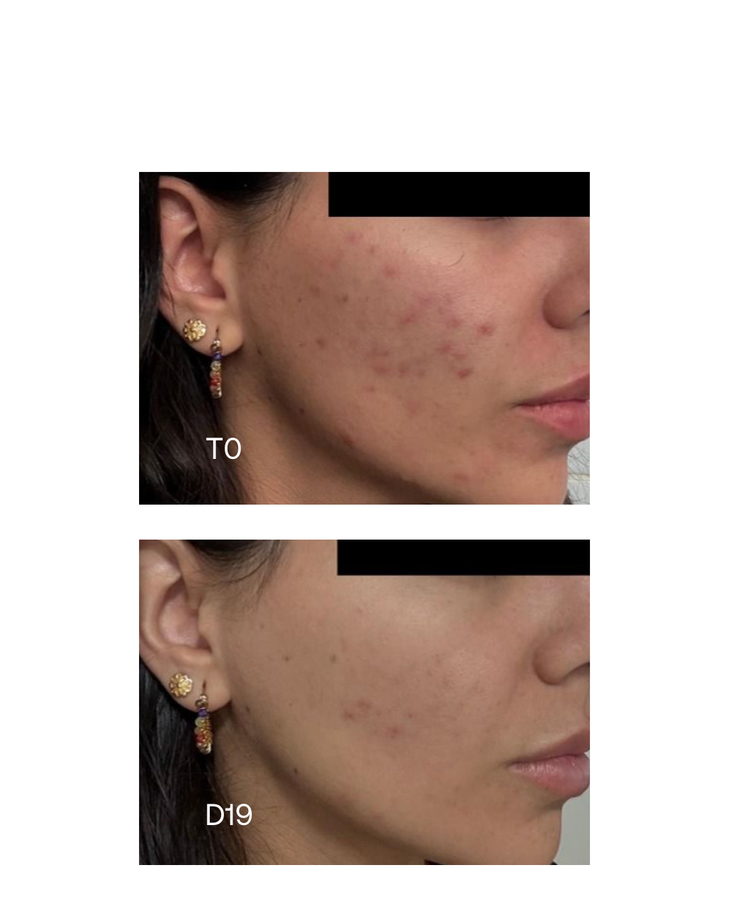 Pure 15AZ serum
